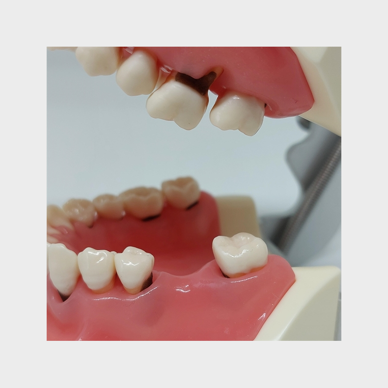 Model til trning af parodontale behandlingsteknikker 